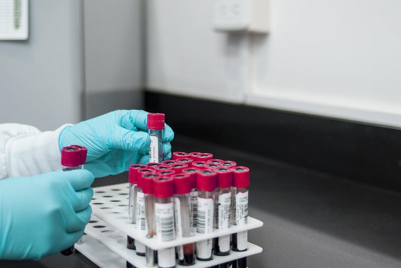 A/b test en 2026 : les secrets pour booster vos conversions